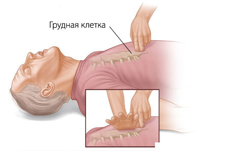 Первая помощь утопающему